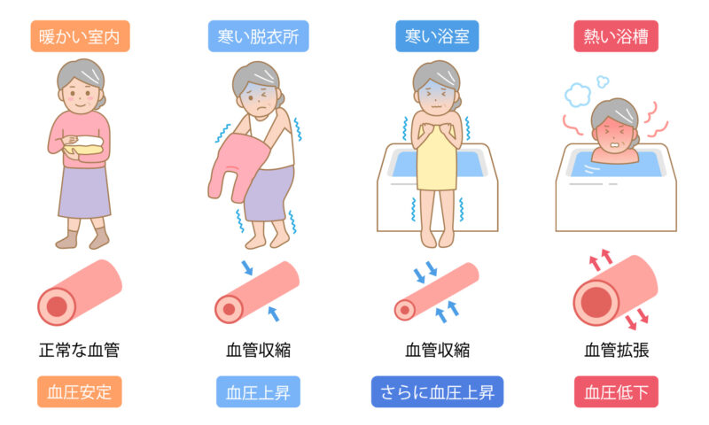 枚方 寒いお風呂は危険 パナソニック オフローラ に替えて健やかに 株式会社フォワードbhl